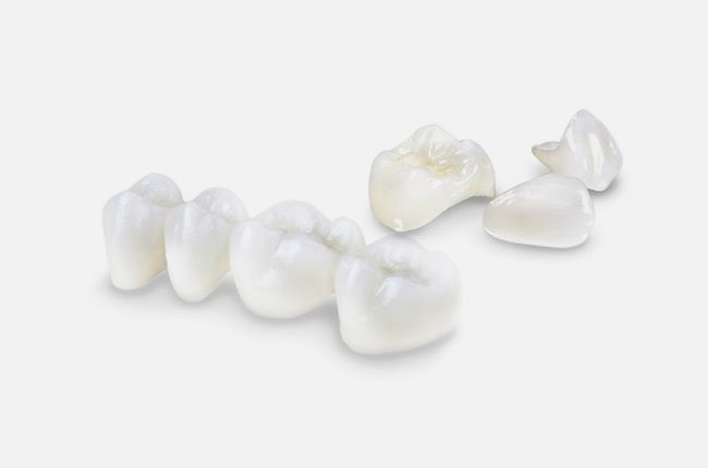 materiale-lavorazioni_ponti-corone-anatomici(0)